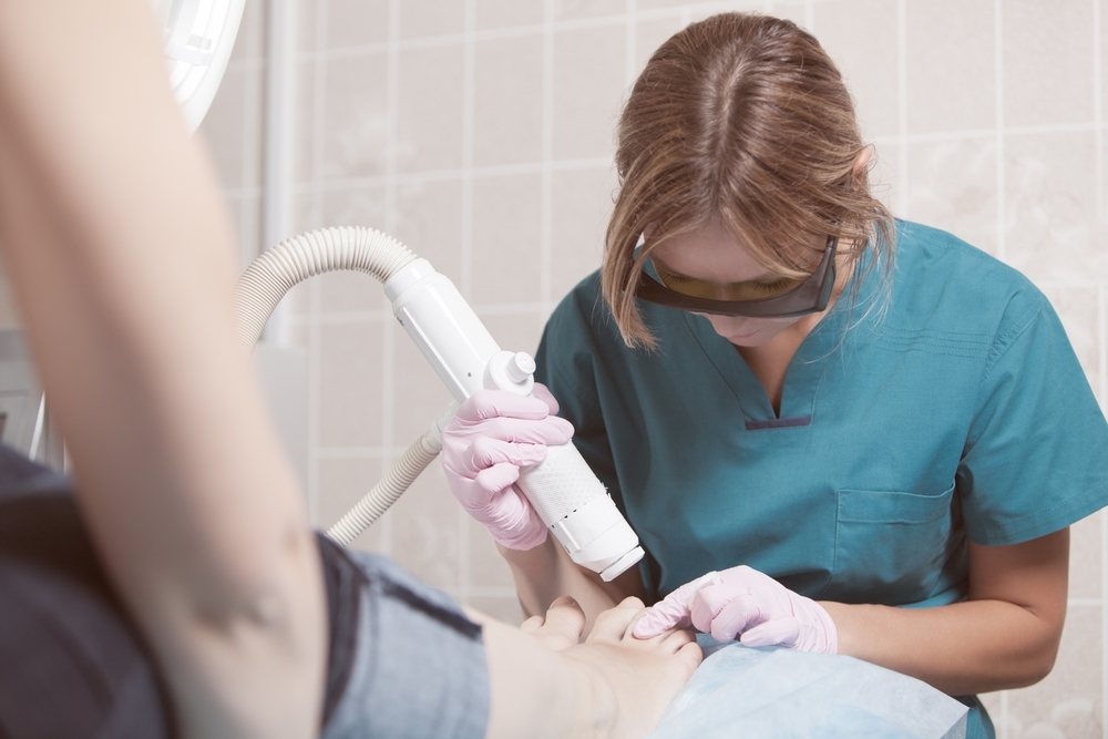 laser fungal nail treatment