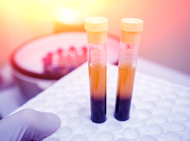 PRP therapy Lakewood Ranch